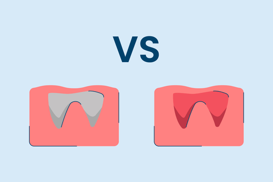 Dry Socket vs. Normal Socket After Tooth Extraction