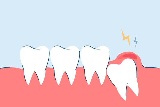 Wisdom Tooth Infection: Prevention, Symptoms, and Treatments