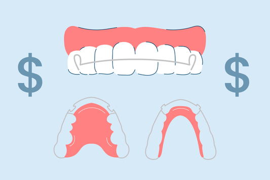 How Much Do Retainers Cost? Types, Benefits, and Care