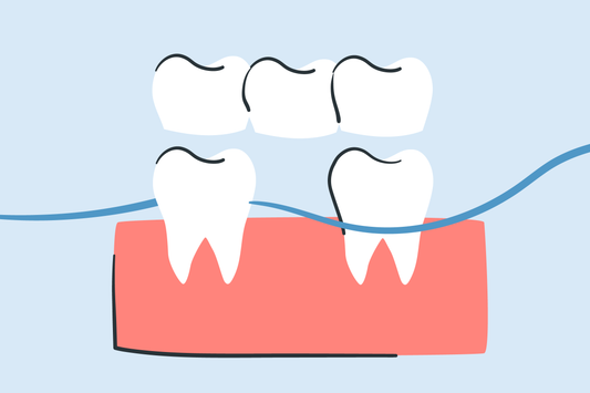 how to floss a bridge