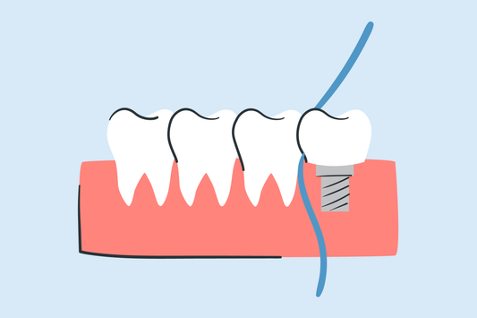 how to floss dental implants