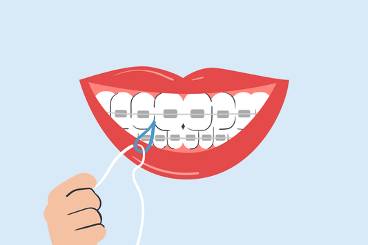 how to floss with braces