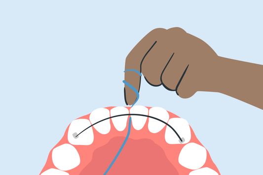 how to floss with permanent retainer