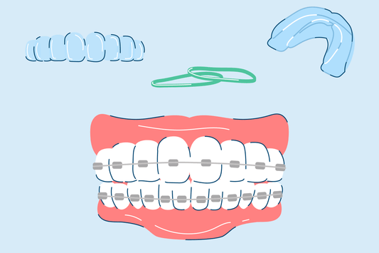 5 Teeth Straightening Options Compared and Explained