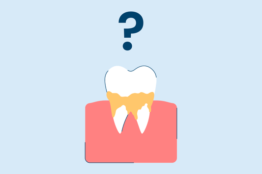 What Causes Calcium Buildup on Teeth?